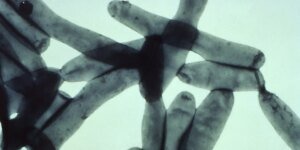 Um surto de doença dos legionários ligado a duas áreas de Londres está sendo investigado pela UKHSA