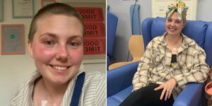 Paciente de 26 anos com câncer de cólon relembra os sintomas que levam à doença