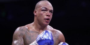 Fabio Wardley dá atualizações de saúde para sua mãe após perder a luta de boxe de Daniel Dubois